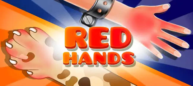 Red Hand Slap Game SellUnitySourceCode